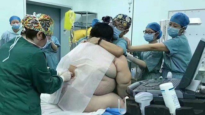 16 y bác sĩ đỡ đẻ cho bà bầu nặng... 130kg Bác sĩ gặp khó khăn khi gây tê cho sản phụ 140 kg. Ảnh: Sina