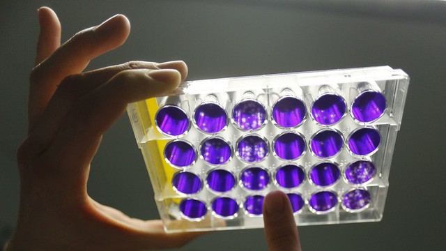 Mỹ tham vọng phát triển công nghệ 'làm chậm cái chết' (Ảnh minh họa: Reuters)