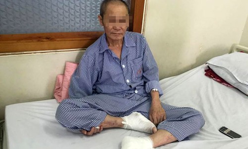 Người đàn ông bị bỏng chân vì dùng đèn sưởi đá muối quá nóng Bệnh nhân bị bỏng nặng ở hai bàn chân. Ảnh: T.N.