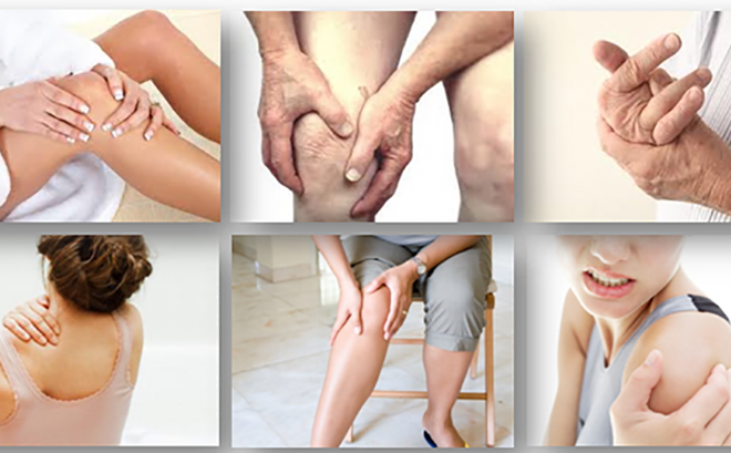 Thực hư công dụng của Viên xương khớp Chako Các triệu chứng của Viêm Khớp
