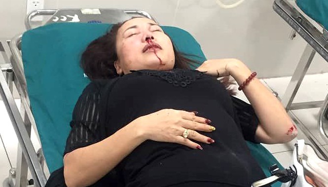 Tin mới vụ nữ giám đốc tố bị côn đồ nổ súng truy sát Bà Mai Thị Hồng Thức bị truy sát phải nhập viện.
