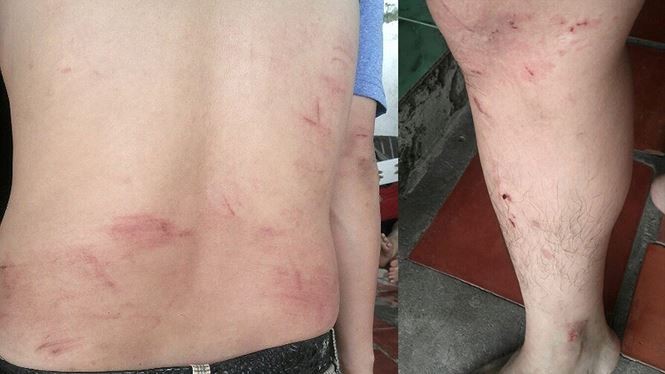 Tình tiết bất ngờ vụ người trả lời phỏng vấn VTV9 bị đánh dã man Nhiều vết thương trên người anh Quý
