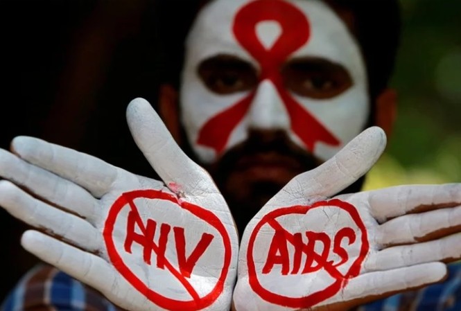 Đại dịch AIDS có nguy cơ bùng phát trở lại Các chuyên gia cảnh báo, thảm họa AIDS sẽ hiện hữu.