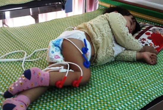 “Thủ phạm” vụ trẻ điều trị viêm phổi bị liệt chân là hội chứng cực kỳ nguy hiểm Chuyên gia y tế nhận định cháu bé mắc phải hội chứng Guillain-Barré, hội chứng mà y học rất hạn chế trong việc điều trị. Ảnh: Anh Khắc Tạo chia sẻ trên facebook