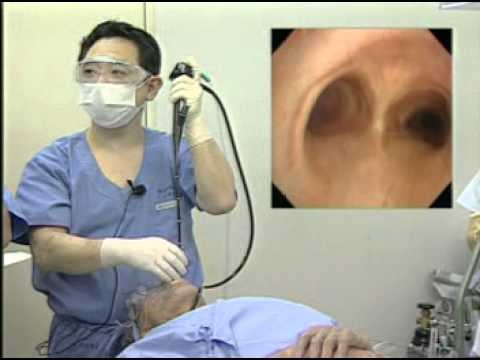 Kỹ thuật nội soi phế quản mới được thực hiện thành công tại BV Bạch Mai Ảnh minh hoạ: Internet