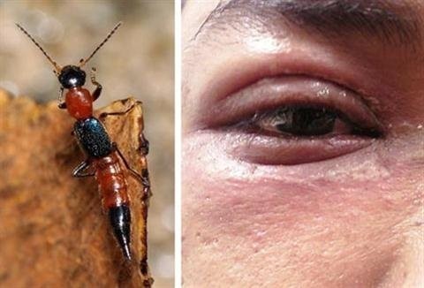 Côn trùng có nọc độc gấp chục lần rắn hổ xuất hiện đầy Hà Nội Ảnh minh hoạ: Internet