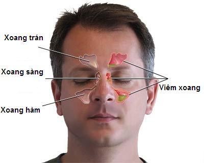 Bệnh ung thư 'ăn' vào não có dấu hiệu chỉ từ đau đầu, nhìn kém Ảnh minh hoạ: Internet