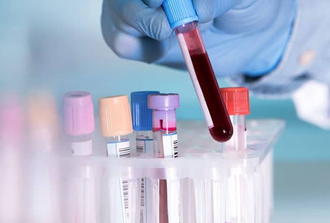 Cắt đôi que thử HIV, viêm gan B: Người bệnh sẽ phải nhận kết quả 'ảo' Ảnh minh họa: Internet