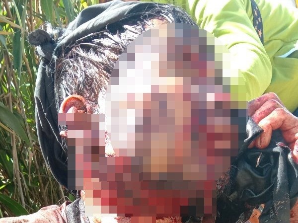 Lên thăm vườn sâm, người đàn ông bị gấu rừng tát nguy kịch Anh Hội bị gấu rừng tấn công trong lúc lên thăm vườn sâm Ngọc Linh. Ảnh H. Thọ