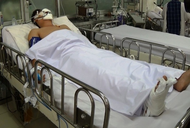 Thượng úy CSGT bị tông nguy kịch khi dừng xe vi phạm ở Sài Gòn Thượng uý Trần Đức Trung đang được điều trị tại bệnh viện Chợ Rẫy.