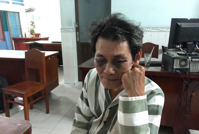 'Yêu râu xanh' bị người dân đánh bầm dập vì sàm sỡ bé gái Ông An tại cơ quan công an.
