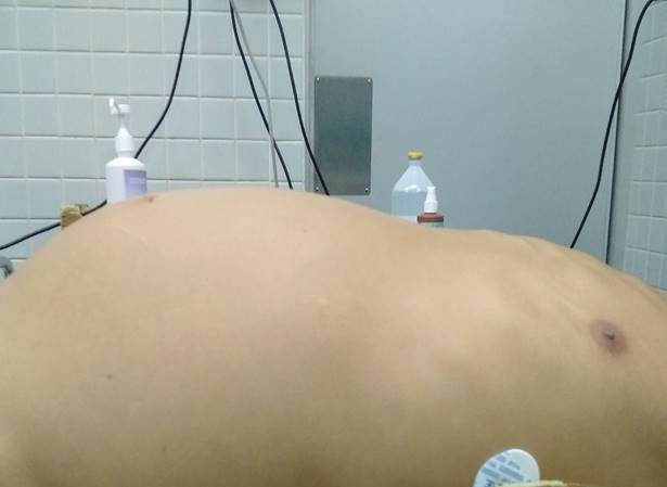 Bệnh viện Chợ Rẫy phẫu thuật 2 người đàn ông “mang bầu” Ảnh do bệnh viện cung cấp.