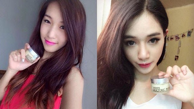 Sau 3 tuần hết sạch nám da, tàn nhang, sạm da, đốm nâu Sau 3 tuần hết sạch nám da, tàn nhang, sạm da, đốm nâu