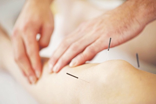 Hiểu đúng về châm cứu Hiểu đúng về châm cứu