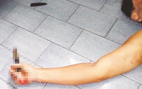 Đâm thấu lưng người tình rồi uống thuốc sâu tự tử Ảnh minh họa