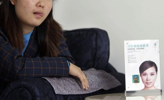 Nhật ký phẫu thuật thẩm mỹ của một nữ sinh Do quá tự ti về vẻ bề ngoài của mình, Vũ Mông đã giấu bố mẹ thực hiện phẫu thuật thẩm mỹ.