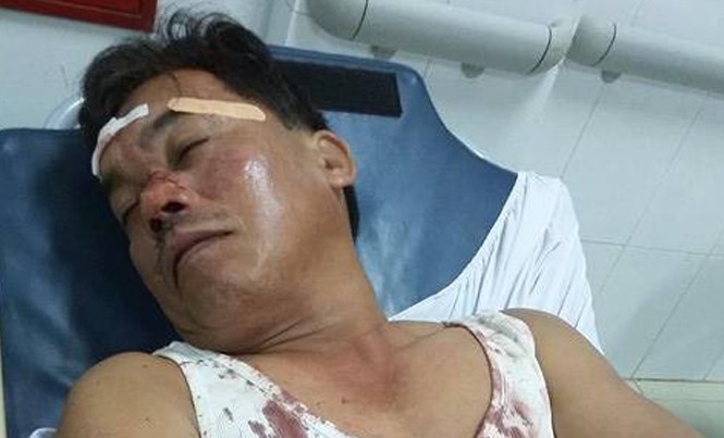 Công an viên bị đánh vỡ đầu khi ngăn hỗn chiến Anh Trung đang được điều trị cấp cứu tại bệnh viện.