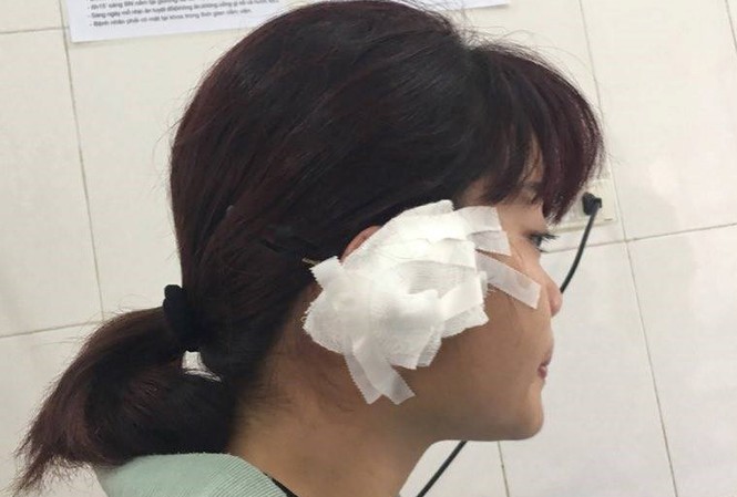 Giáo viên tố bị phụ huynh học sinh cắn đứt tai Chị B.T.H.T - bị phụ huynh cắn đứt tai.