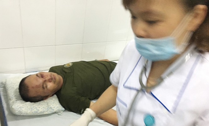 Điều tra, tìm được manh mối vụ “côn đồ” đánh bảo vệ nhập viện Cùng với các vết thương chưa lành, anh Hảo vừa phải mổ mắt để vá các vết rách.