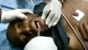 Suýt chết vì... hóc điện thoại di động Suýt chết vì... hóc điện thoại di động