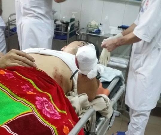 Mẹ bàng hoàng thấy con tự chặt đứt cánh tay trong nhà tắm Anh Ngọc đang được điều trị tại bệnh viện.