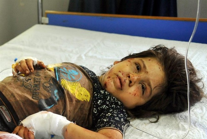 Đánh bom tự sát liên hoàn tại thủ đô Syria, 50 người thương vong Một bé gái bị thương trong vụ nổ gần quảng trường Tahrir, Damascus, ngày 2/7. Ảnh: Tân Hoa Xã