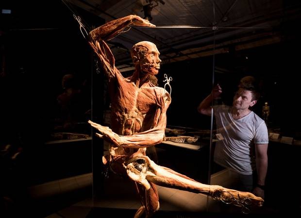 Xem triển lãm hài cốt, khách ‘cuỗm’ hai ngón chân giá trị 5.500 USD Xác chết nhảy múa trong triển lãm Body Worlds Vital.