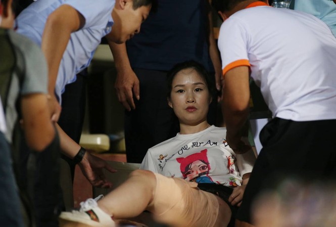 Trúng pháo sáng, nữ cổ động viên bị thương hở xương, phải ghép da Nữ CĐV được sơ cứu tại sân. Ảnh: Vnexpress