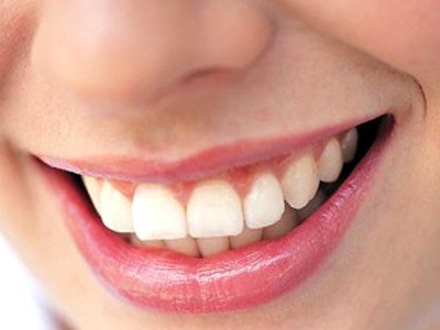Vì sao chảy máu chân răng? Vì sao chảy máu chân răng?