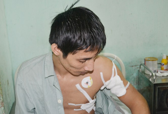 Bị chém vì không chịu trả... tiền lãi Anh Chu Tiến Đức tại bệnh viện E chiều 16-2