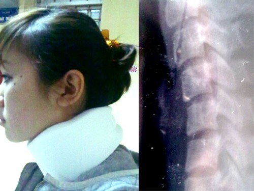 Chủ tịch CLB BĐS Hà Nội bị tố đánh con trật xương cổ Chủ tịch CLB BĐS Hà Nội bị tố đánh con trật xương cổ