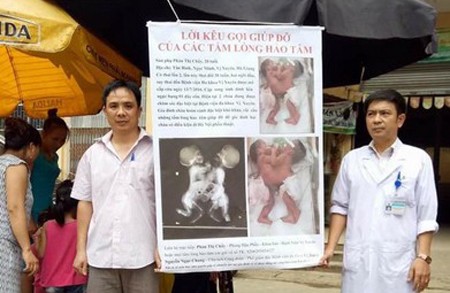 Bác sĩ quyên góp giúp đỡ cặp song sinh nghèo khó Các bác sĩ Bệnh viện Đa khoa huyện Vị Xuyên Hà Giang ra chợ kêu gọi giúp đỡ cặp song sinh dính liền. Người mặc áo blouse là bác sĩ Nguyễn Ngọc Chung.