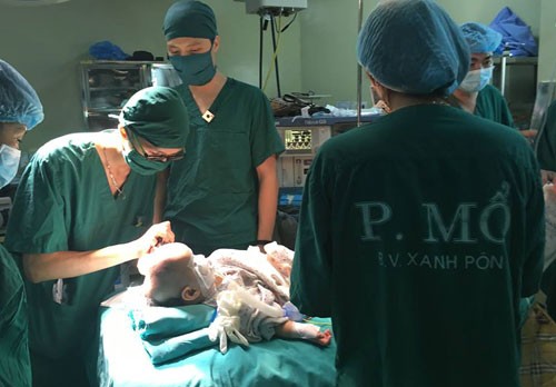 Phẫu thuật cho bé 11 tháng bị biến dạng hộp sọ hiếm gặp Ca mổ kéo dài 5 tiếng sửa lại hộp sọ cho bệnh nhi. Ảnh: Bệnh viện cung cấp.