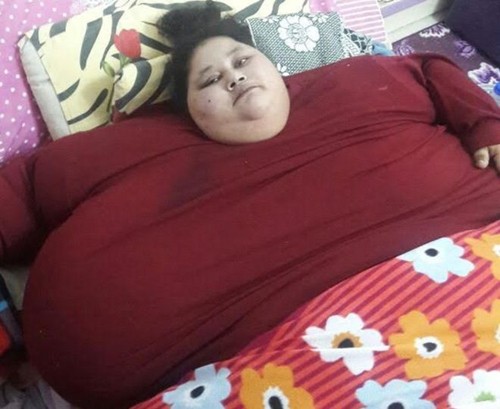 Dùng cẩn cẩu đưa người phụ nữ nặng 500 kg vào bệnh viện Eman Ahmed Abd El Aty được cho là nặng 500 kg. Ảnh: Muffazal Lakdawala