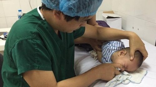 Cách dùng nước muối sinh lý rửa mũi không gây hại cho con BS Xương hướng dẫn cách rửa mũi cho trẻ
