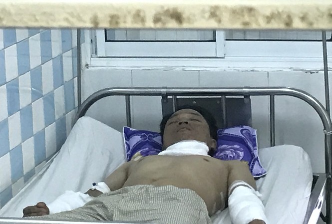 Nổ thiết bị nhà máy gạch, 4 công nhân bị bỏng Công nhân bị bỏng đang điều trị tại bệnh viện Đà Nẵng.