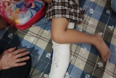 Học sinh gãy chân trong trường: Hiệu trưởng vô cảm? Học sinh gãy chân trong trường: Hiệu trưởng vô cảm?