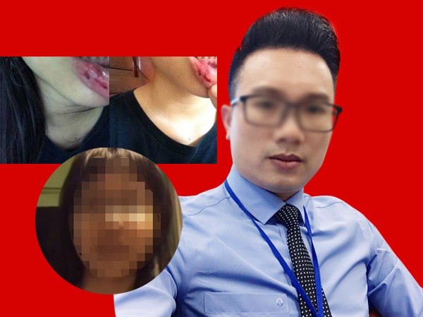 Bố của nữ sinh tố bị bạo hành: Bố của nữ sinh tố bị bạo hành: "Làm cha mẹ, tôi không nên để xảy ra việc này!"