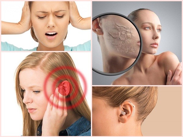 Tại sao bạn bị ngứa tai và làm thế nào để điều trị nó? Tại sao bạn bị ngứa tai và làm thế nào để điều trị nó?