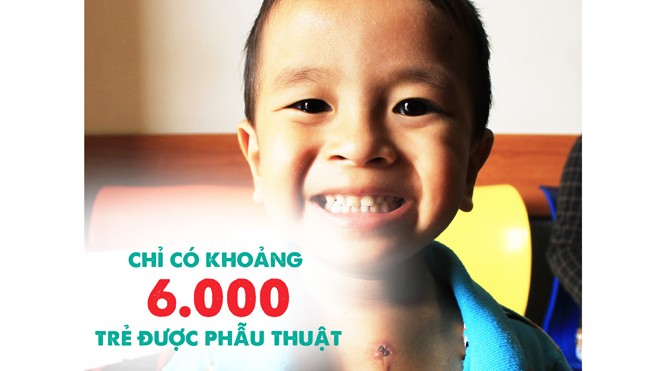 “Phép màu” cho 1.000 trẻ em nghèo bị bệnh tim bẩm sinh