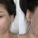 Trần Kiều Ân gây tranh cãi với phương pháp làm đẹp đau đớn
