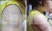 Đình chỉ giảng dạy giáo viên dùng thước đánh học sinh ở Nam Định