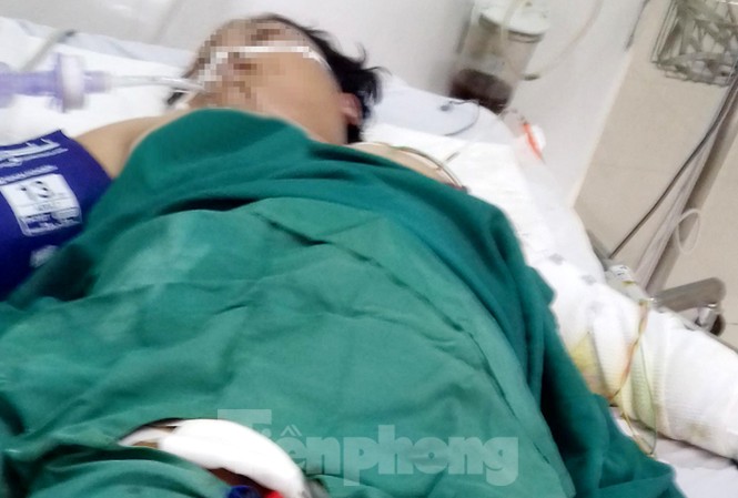 Chồng tưới xăng đốt thai phụ, 2 người thương vong Chị Y Chơ Rung Tăng vẫn hôn mê khi khi được mổ cứu thai nhi