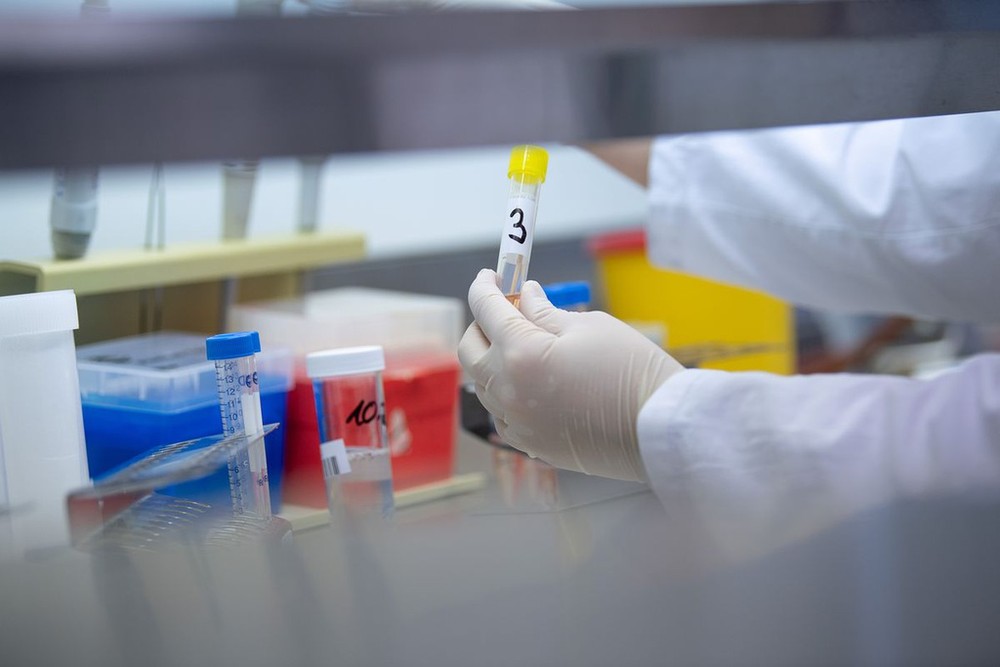 Kết quả xét nghiệm SARS-CoV-2 của gần 7.000 mẫu ở Bệnh viện Bạch Mai