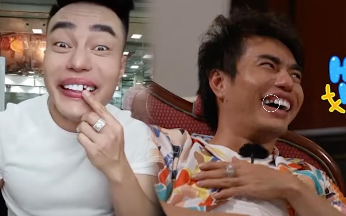 Game show gây cười bằng việc Lê Dương Bảo Lâm rơi răng sứ, cắn vào vai Thúy Ngân ảnh 2