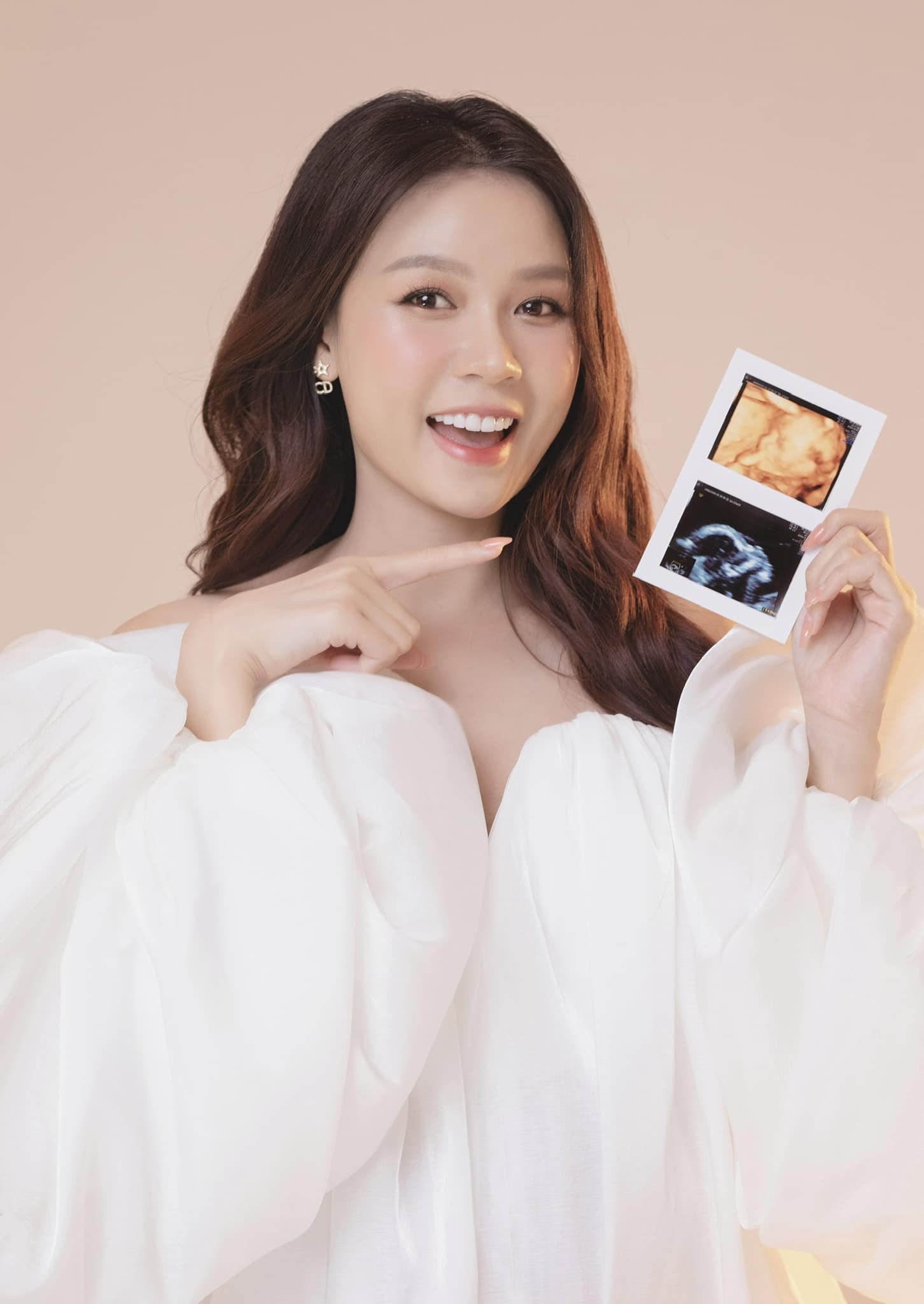 Showbiz 28/10: Sam tiết lộ mang thai khó ảnh 1