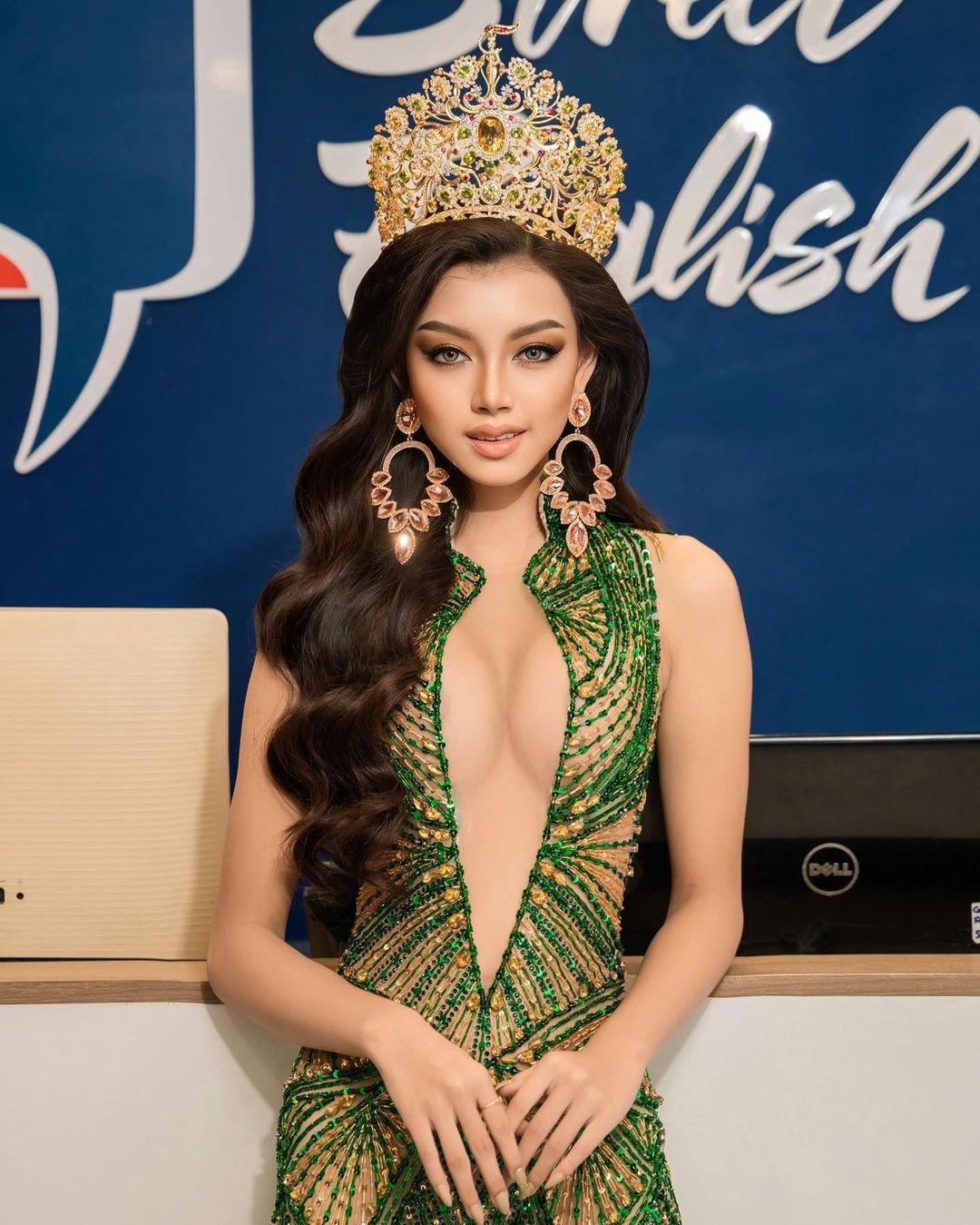 Hoa hậu 16 tuổi bị chỉ trích vì khoe vòng một phản cảm ảnh 2