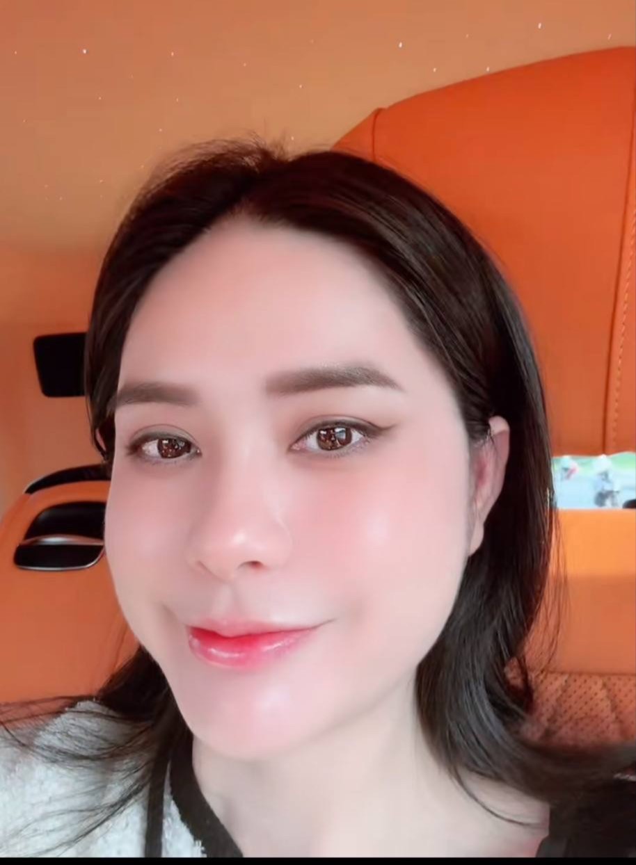 Đoàn Di Băng quảng cáo sản phẩm vừa bị thu hồi là mặt nạ tế bào gốc, đắp 10 phút giảm ngay 80% vết thương ảnh 4
