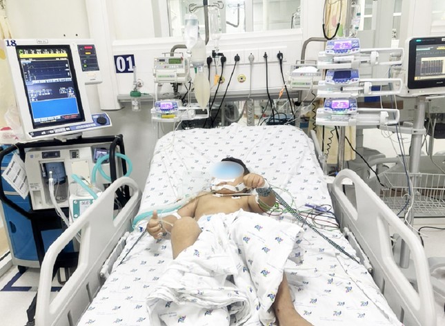 Hai anh em ruột nguy kịch vì bị ong vò vẽ tấn công ảnh 1