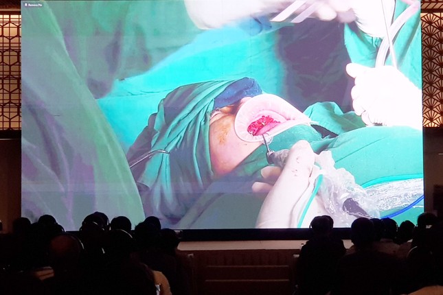 Một chuyên khoa y tế không có bệnh nhân phải ra nước ngoài điều trị ảnh 2